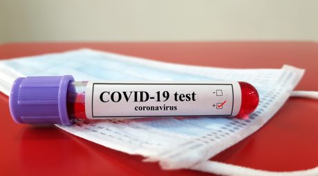 COVID-19 Antibody Test