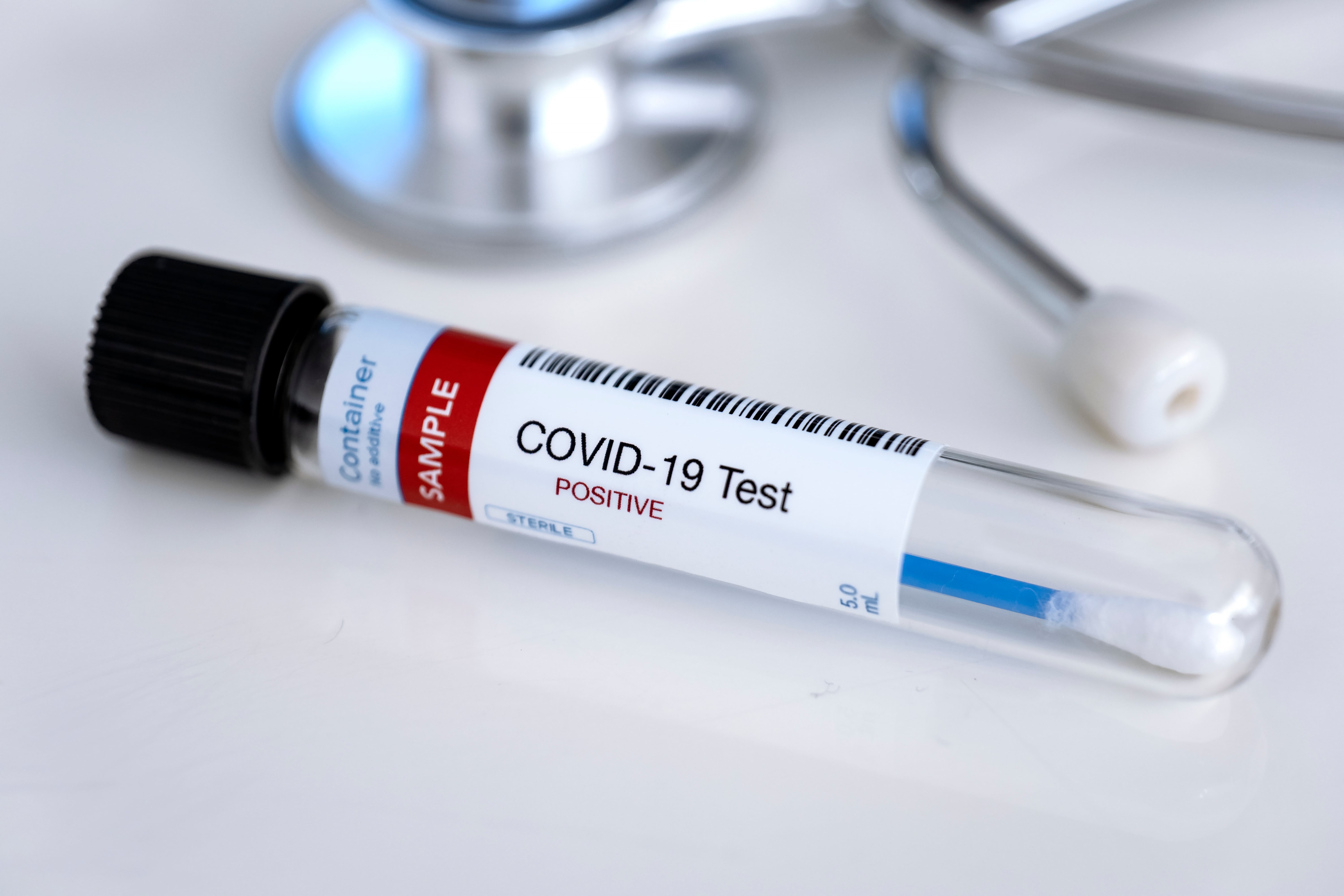 Coronavirus Test 2020